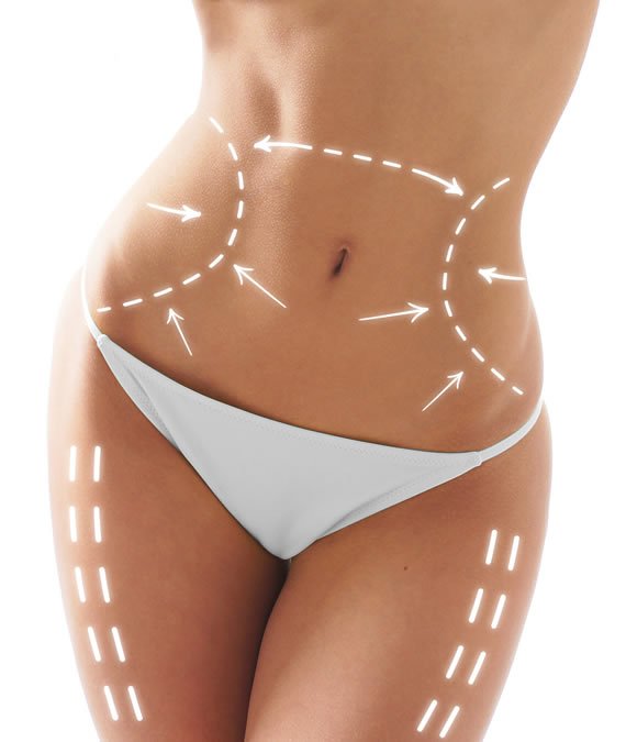 Lipoaspiração e lipoescultura